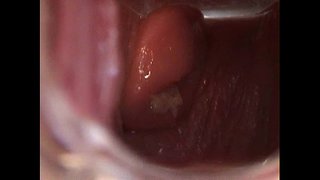 Avy Vula Pussy kunye Speculum